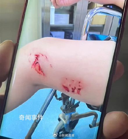 北海一浴場突發不明魚類傷人事件 事發時水體十分渾濁漂浮有垃圾