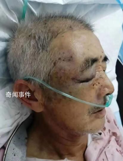 孫子目睹爺爺遭村霸毆打后疑抑郁跳河 老人被毆打腦出血入院