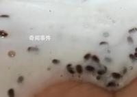 女生稱海飛絲洗發水擠出大量蟲卵 實在是太惡心了