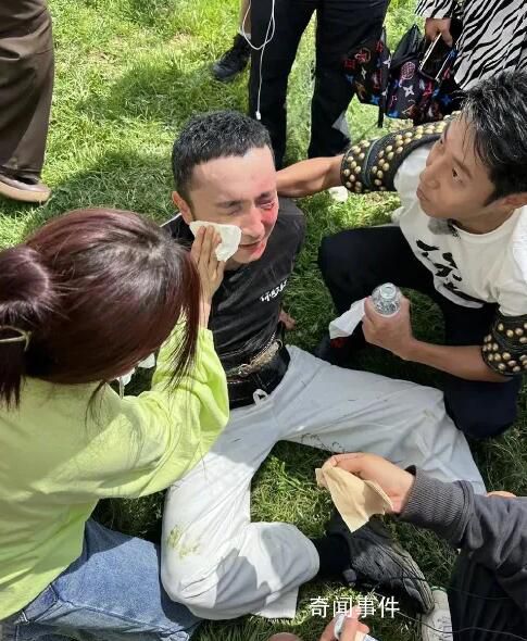 尼格買提錄節目摔傷 引發不少網友關注