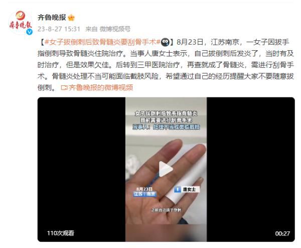 女子拔倒刺致骨髓炎要刮骨手術 骨髓炎處理不當可能面臨截肢風險