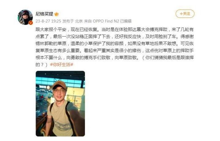 尼格買提報平安 看起來嚴重其實是很小的擦傷