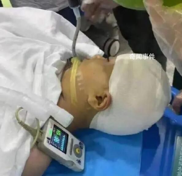 小學生被男教師打碎頭骨?警方介入