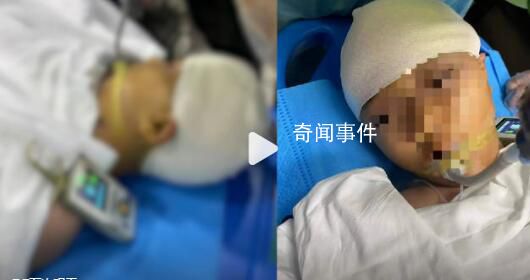 打破學生頭骨老師停職接受公安調查 受傷學生已及時送醫治療