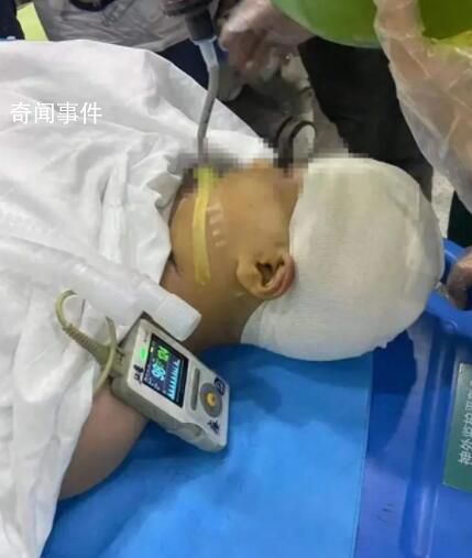 被老師打傷女孩頭部水腫有感染風險 引發了網友們的關注