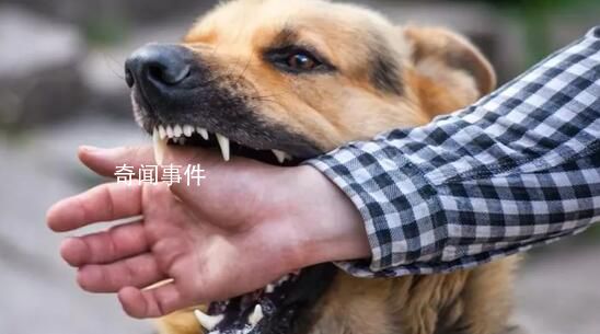 狂犬病潛伏期十幾年?專家辟謠