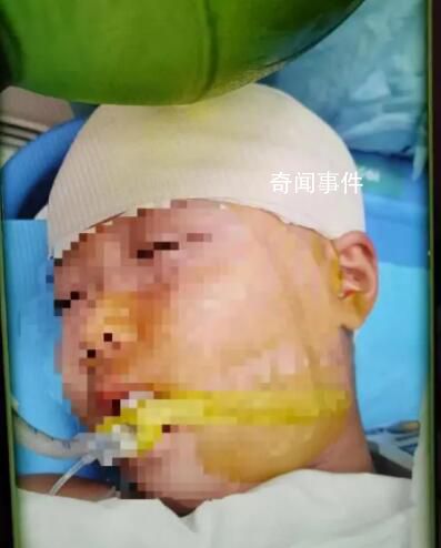 被打破頭骨女生已清醒?家屬回應(yīng)