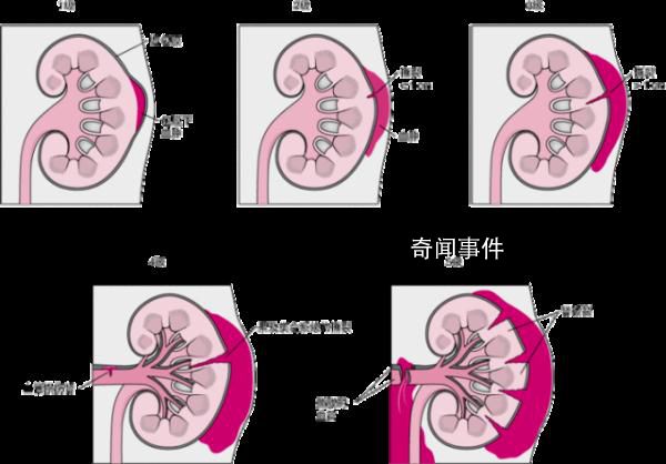 女生經(jīng)期用按摩儀按腰致腎破裂 這些情況切記不要亂按摩