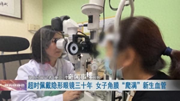 女子戴隱形30年雙眼角膜長滿血管 每天佩戴隱形眼鏡時長超12小時