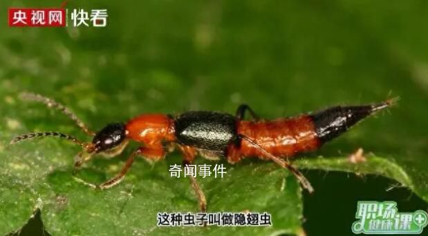 河南多地已發(fā)現(xiàn)隱翅蟲 隱翅蟲的毒性有多強
