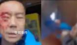 游客遭穿制服人員毆打 其妻發聲