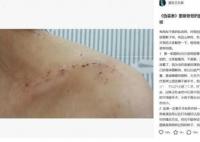 胡歌被曝拍偽裝者時砸斷女主鎖骨 并怒懟胡歌粉絲
