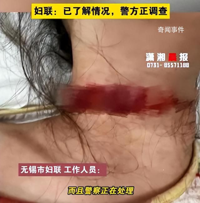 女子稱孕期遭家暴被丈夫拿刀割脖子 目前警方正在調查處理