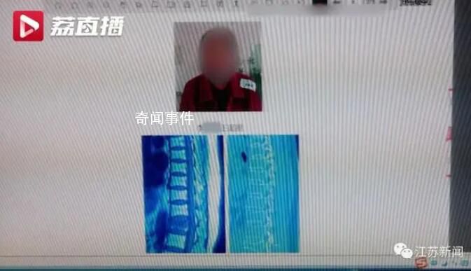 員工參加公司蛙跳游戲致十級傷殘 法院判決公司承擔70%的賠償責任