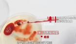 男子誤喝防凍液血液呈膠凍狀離世 治療無效不幸去世
