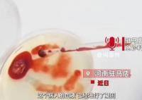 男子誤喝防凍液血液呈膠凍狀離世 治療無效不幸去世