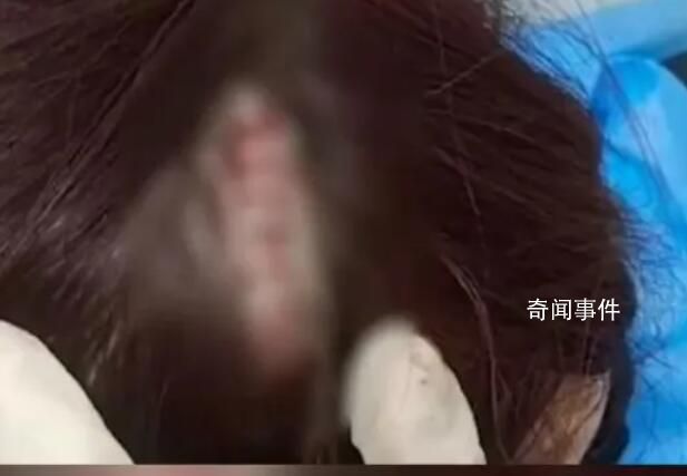 女子在景區(qū)提醒禁練鐵頭功處撞破頭