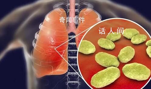 寧波一家三口相繼患上支原體肺炎 目前已好轉出院