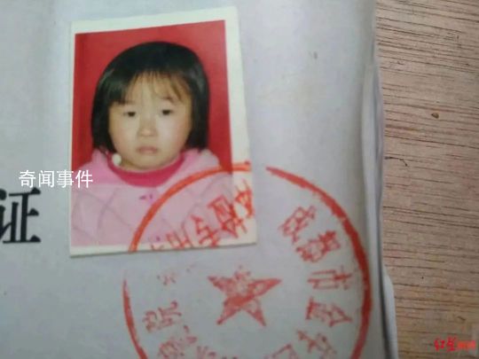 燙傷女孩刷視頻找到親生父母