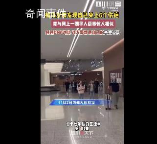 女孩身上6個傷疤同尋人啟事一致