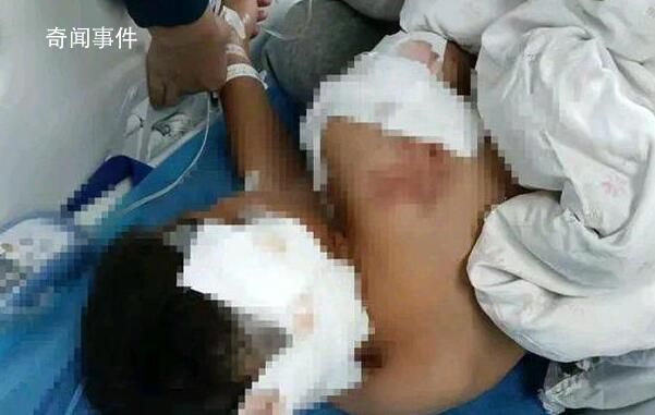 被狗咬傷男童已出ICU:耳朵缺一塊