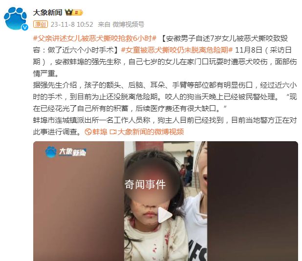 安徽7歲女童被惡犬撕咬致毀容 目前當地警方正在對此事進行調查
