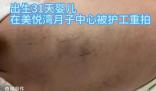 陜西月子會所護工把嬰兒打成腦損傷