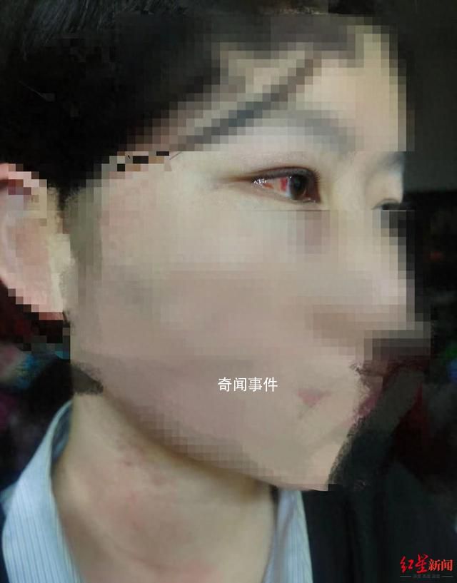 懸賞找打人者事件3人已被抓 3名施暴者均未成年