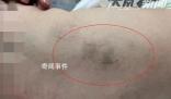 育嬰師拍打嬰兒被拘15天 警方調查中