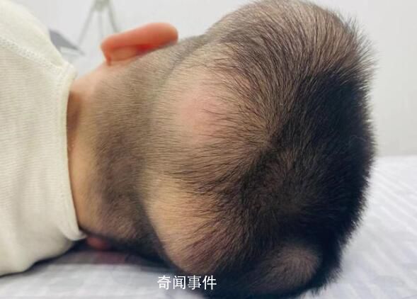 5歲男童患“超級罕見病” 國內(nèi)此前僅報道過1例