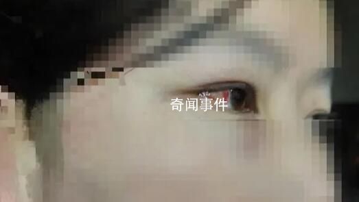 “女兒被打父親萬元懸賞尋兇”追蹤