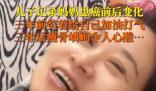 淚目!兒子記錄媽媽患癌三年的變化