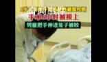 男童手臂伸進籠子被藏獒咬斷 手術差不多花了6個小時