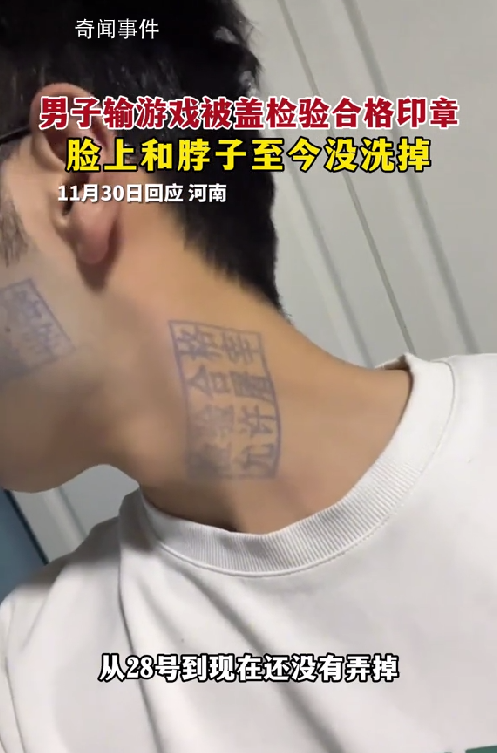 男子玩游戲被蓋豬肉印章去除不了 不得不戴上口罩