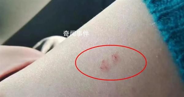 旅客稱花2500元住酒店被蛇咬 事發房間已經封鎖