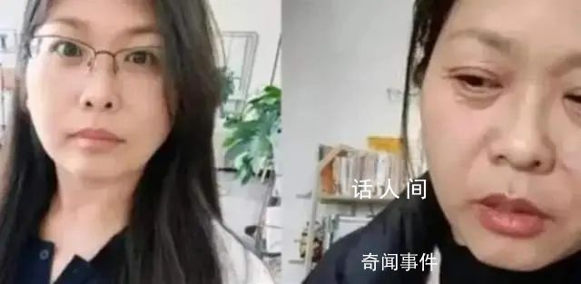 女子自稱20天內“老了30多歲” 引發網友關注