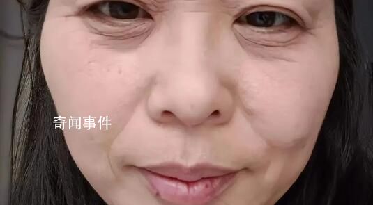 斷崖式衰老女子本以為能漂亮過余生 引發網友熱議