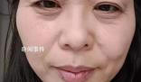斷崖式衰老女子本以為能漂亮過余生 引發網友熱議