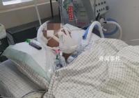 初中生被同學打傷住院 親屬:仍昏迷
