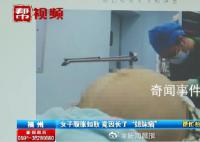 23歲女子腹脹如鼓取出42斤腫瘤