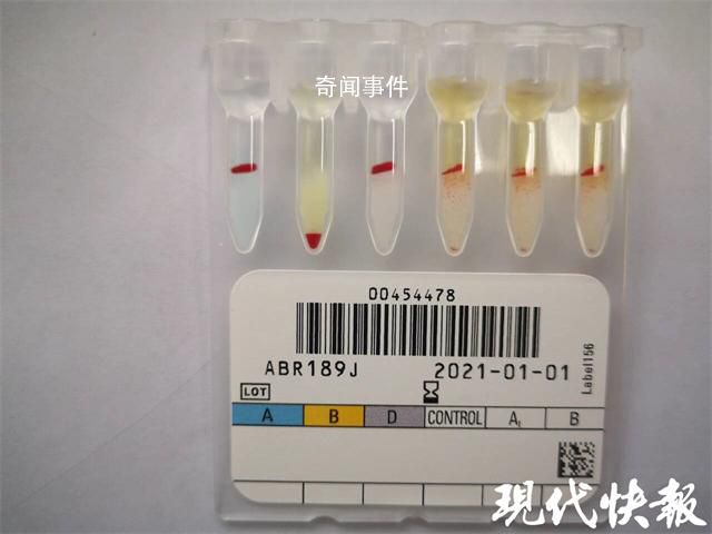 江蘇泰州發現罕見小p血型 我國記錄在案的小p血型僅有10余人