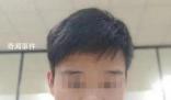 小伙拔牙拍片時暈倒 開顱手術后去世