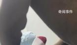 父親瓷娃娃般照顧抑郁癥女兒